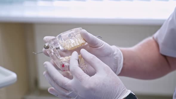 Doctor shows on a plastic jaw sample or model different methods of teeth treatment. alt