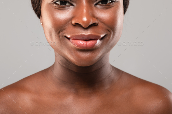 Neck Wrinkles. Closeup Of Smiling Black Woman With Venus Rings On Skin