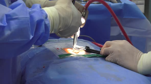 Spine Surgery, Spinal Disc Herniation 