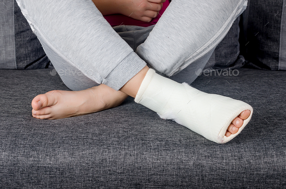 Child with Plaster bandage on leg cast and toes after injury fracture, dislocation, sprain.