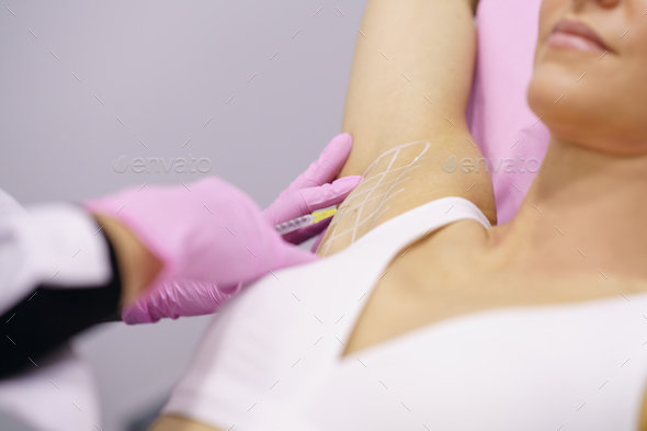 Doctor makes intramuscular injections of botulinum toxin in the underarm area against hyperhidrosis