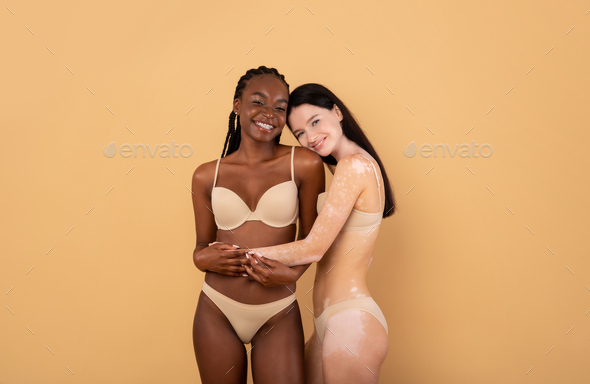 Diverse Beauty. Two Beautiful Women With Different Skin Types Posing In Underwear