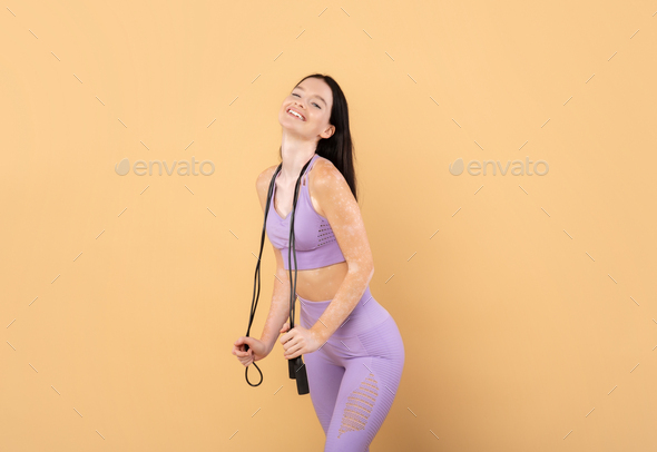 Sporty Young Lady With Vitiligo Skin Disorder Holding Skipping Rope