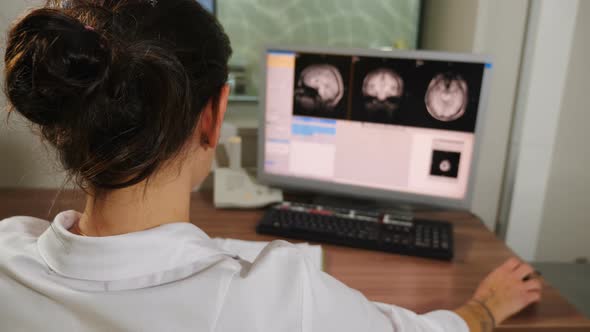 Radiologist Looking at Monitors with Brain MRI Image Results in Control ...