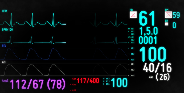 Electrocardiogram Monitor