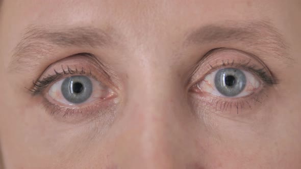 Blinking Eyes of Aged Woman alt