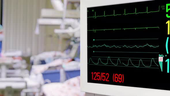 Vital Sign Monitor in Intensive Care Unit
