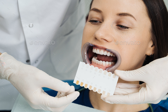 Dentist checking and selecting color of young woman's teeth - Stock Photo - Images