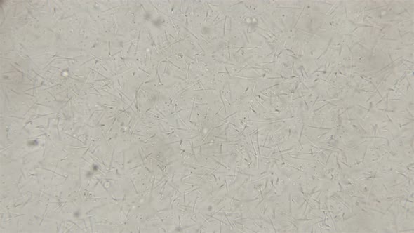 Colony of Rod-shaped Bacteria Appearing in Decaying Organisms alt