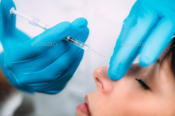 Doctor Contouring Women’s Nose Bridge for Dermal Filler