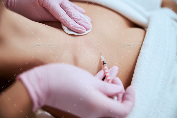 MP - ADD Decolletage - The Cosmetic Clinic