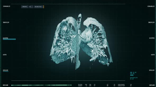 Medical Scan Interface With X-Ray Scan Device Researching Human Lung Organ alt