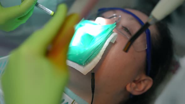 Dental Assistant Hands Leaving with UV Curing Light and Unrecognizable Dentist Inserting Filling in alt