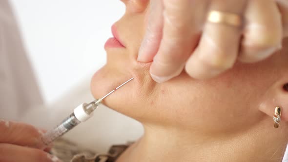 Cosmetologist Injects Large Metal Needle Into Patient Cheek alt