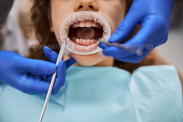 Child going through a dental procedure with a rubber dam