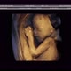 3D Ultrasonic Of A Baby - VideoHive Item for Sale