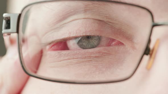 Gray Eye of Middleage Caucasian Male with Diopter Correction Glasses Stretching Eyelid to See Better