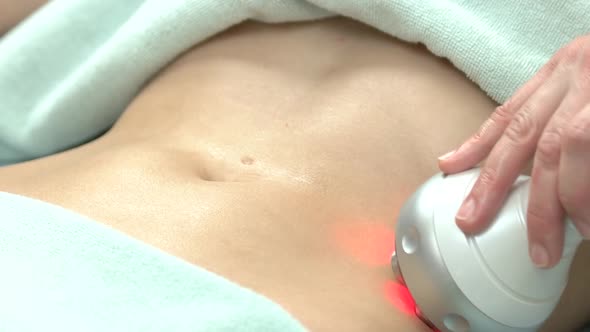 Rf Skin Tightening Belly alt