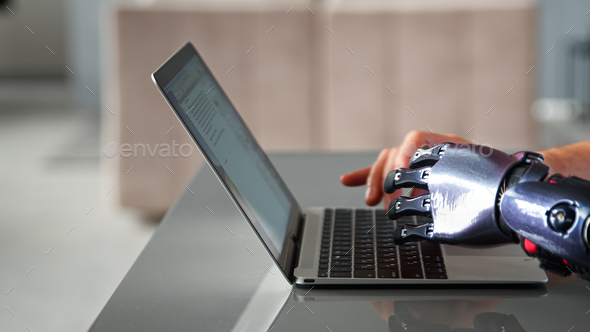 Black bio limb prothesis and healthy hand appear over laptop and type on keyboard - Stock Photo - Images