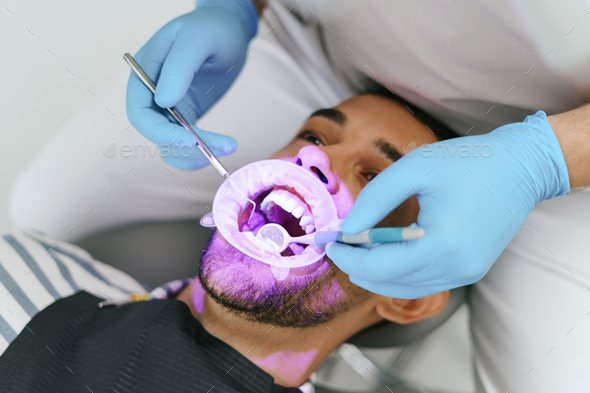 Male dentist hands examine patient