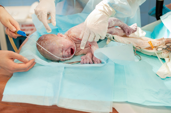 a newborn baby lies on the operating table for delivery immediately after birth