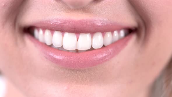 Smiling Woman Mouth With Perfect Teeth