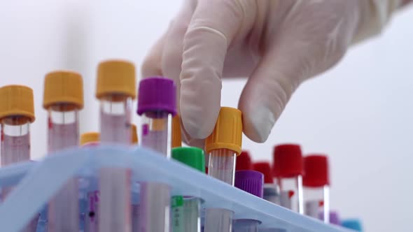 Lab Worker Wearing Medical Gloves Is Taking Test Tubes for Blood Sample Rack Dna, Close-up alt