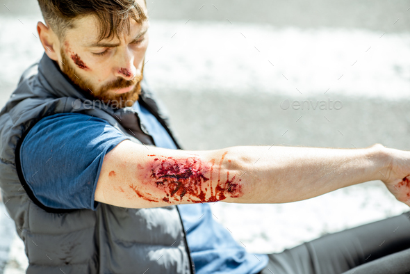 Injured man after the road accident