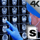 Doctor Checking Mri - VideoHive Item for Sale