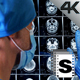 Surgeon Checking Mri - VideoHive Item for Sale