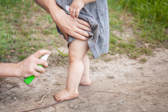 Dad treats his daughter with mosquito spray. The man uses spray on the child\'s arms and legs