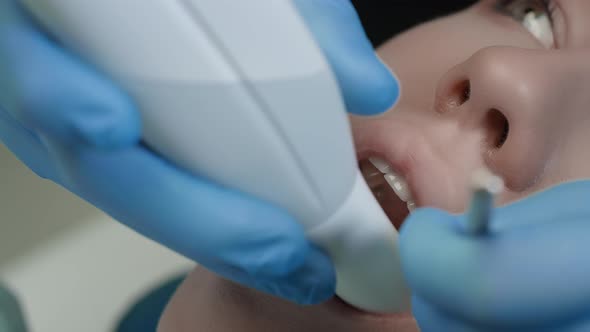 Doctor Scans the Patient's Teeth in the Clinic alt