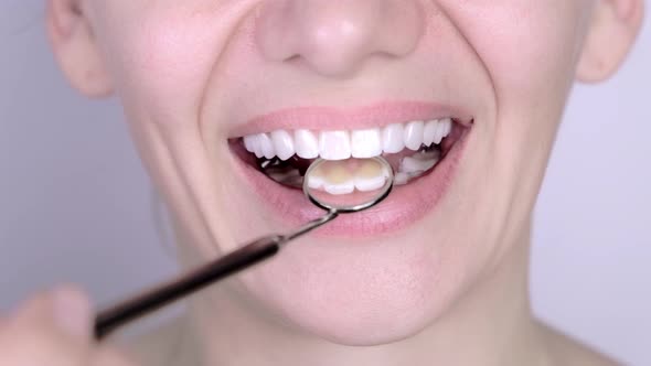 Perfect White Teeth Veneer Smile with Dental Mirror Close Up Female Winner Smile Dental Care and alt