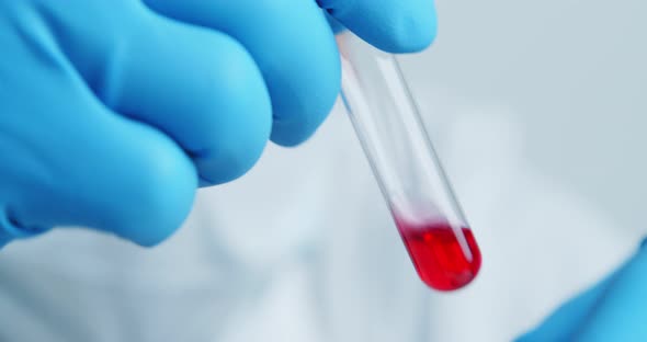 Medical Worker of the Laboratory Carefully Examines the Serum in a Glass Tube alt