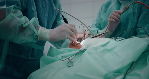 The surgeon performs a surgical operation to remove the tonsils ...