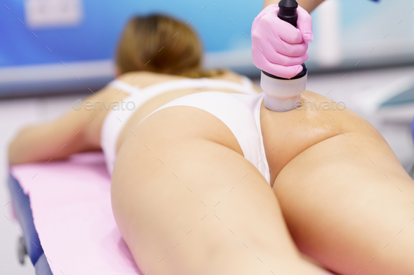 Woman receiving anti-cellulite treatment with radiofrequency machine in a  beauty center stock photo