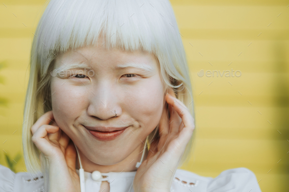 Cute albino girl listening to her favorite music through earphones - Stock Photo - Images
