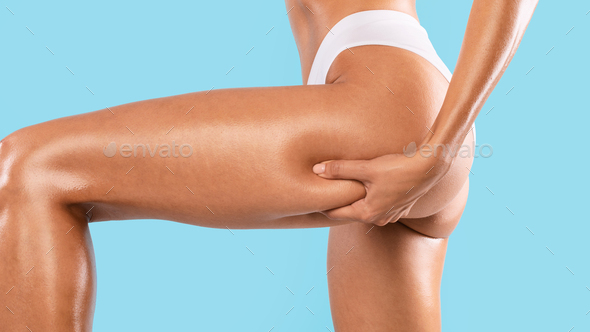 Close Up of Woman Buttocks with Cellulite Stock Photo - Image of
