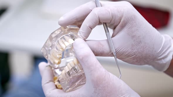 Doctor shows on a plastic jaw sample or model different methods of teeth treatment. alt