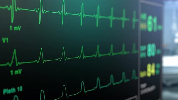 Patient Monitor Displays Vital Signs ECG Electrocardiogram EKG, Oxygen Saturation SPO2 and alt