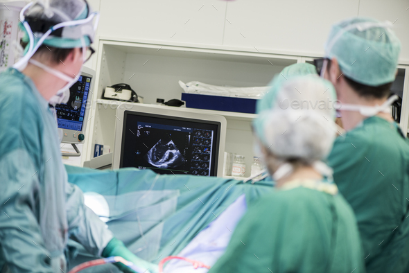 Heart surgeons and operating room nurse looking at monitor