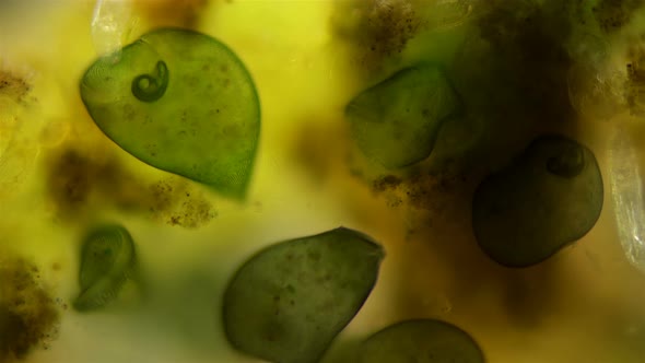 Colony Infusoria Stentor Under the Microscope, the Family Stentoridae, Class Ciliata alt