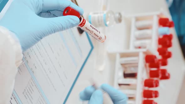 Positive Test Result for Hepatitis C Disease in Hand Doctor with Plastic Flask alt