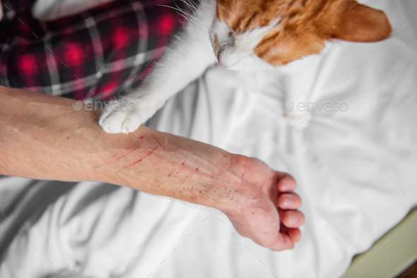 Rabid white-red cat furiously scratched, bit through the mans hand until it bled. Pet attack.