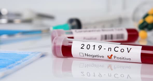 Blood Test Tube with Coronavirus Disease