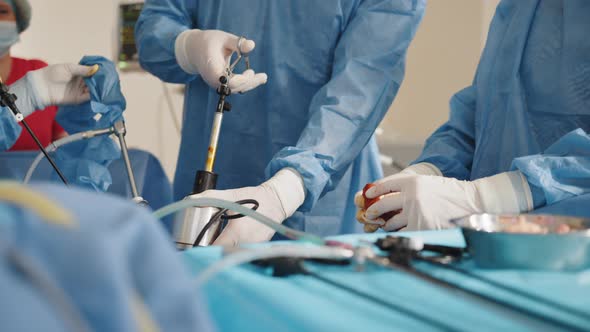 Surgeons Team During Process Operation Uterus Removal with Surgical Laparoscopy alt