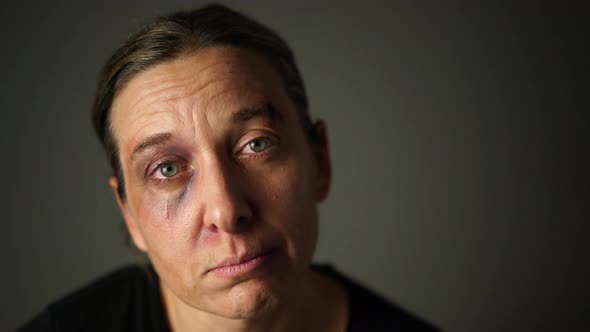 Woman With Black Eye and Tears