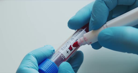Hands of a Microbiologist or Medical Professional with Blue Surgical Gloves Marking the Blood Test alt