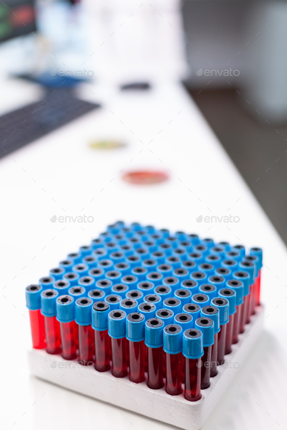 Vacutainer tubes for collecting blood samples during biological