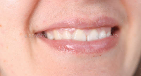 Close-up of a woman\'s face with a mustache over her upper lip.